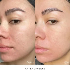 Skin Activator