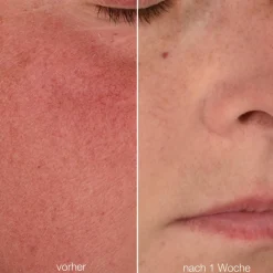 Stabilizing Repair Cream