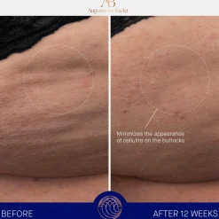 The Body Cream