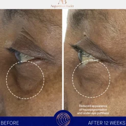 The Eye Cream Nomad