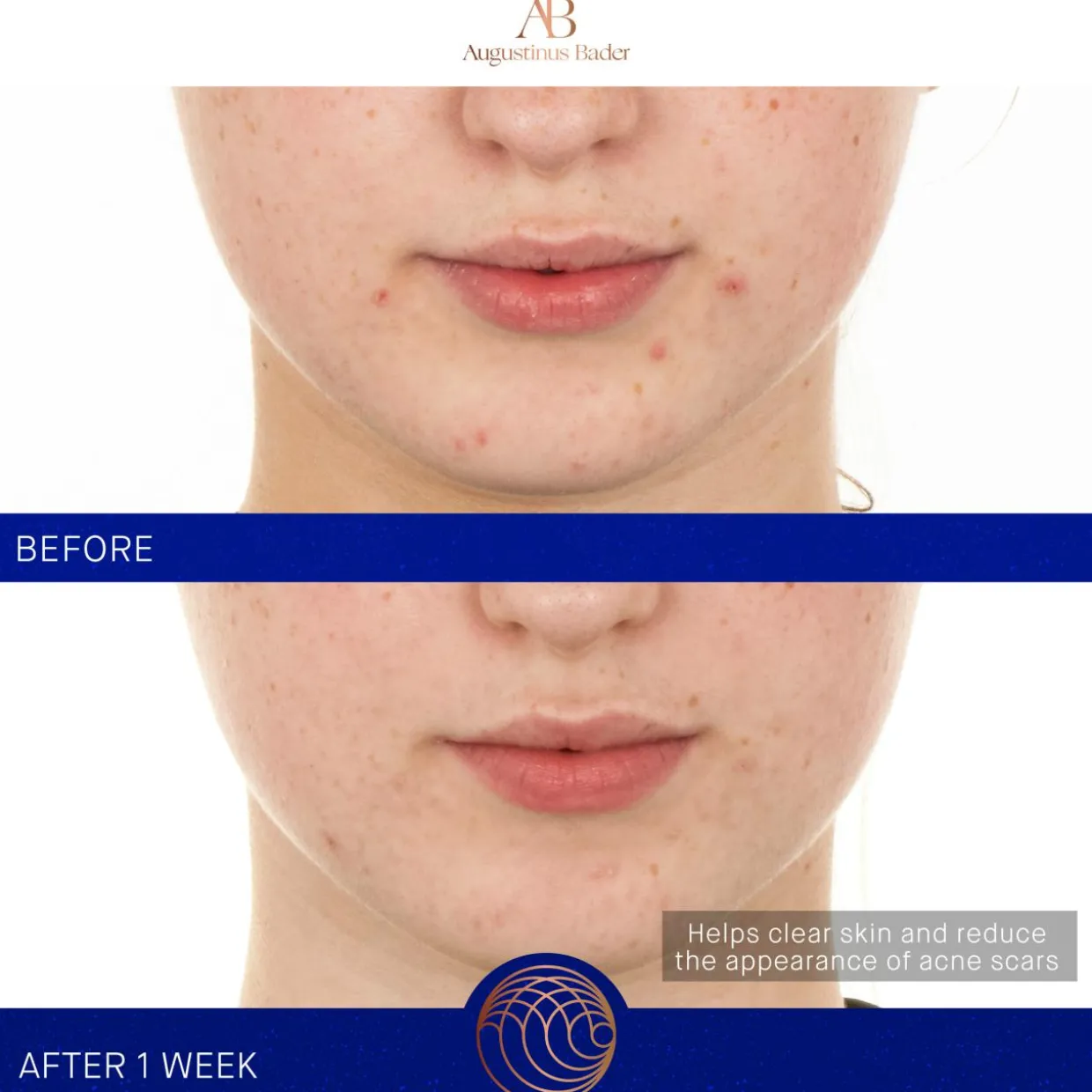 The Retinol Serum
