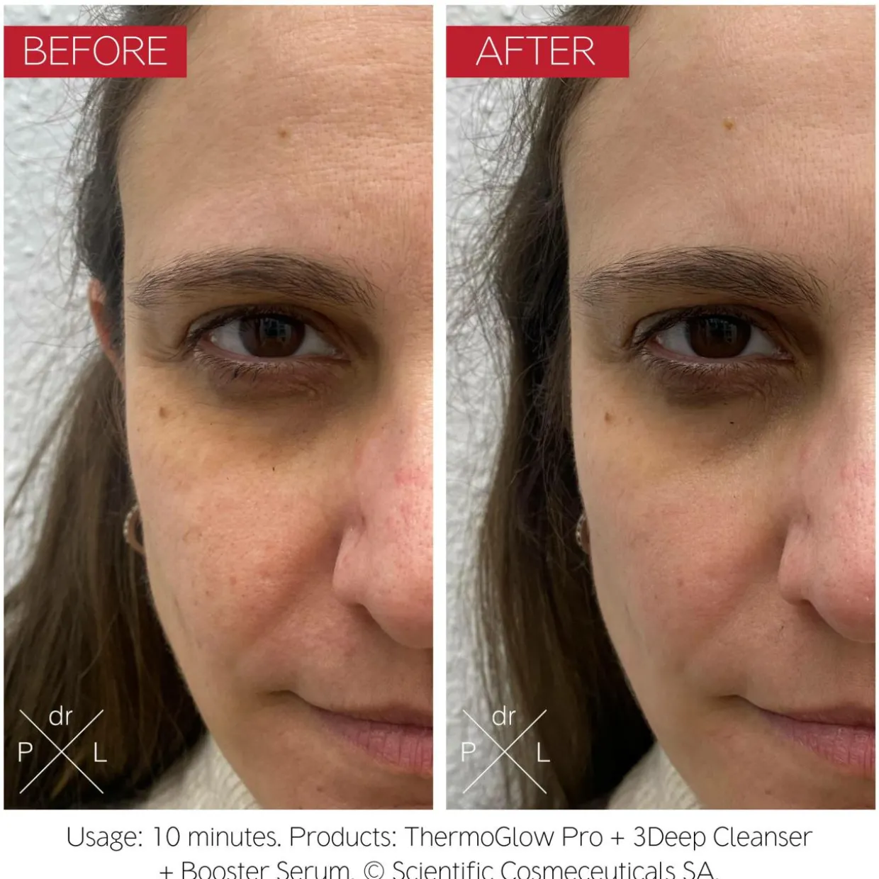 The Thermo Glow Pro