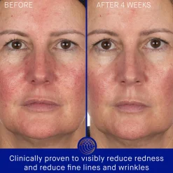 The Hydrogel Face Mask Single