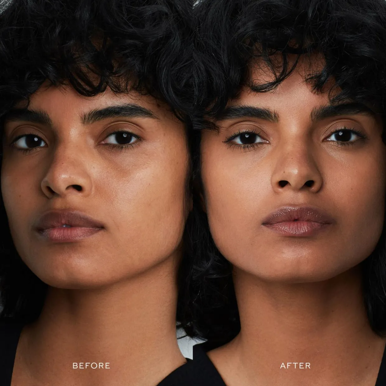 Vital Skincare Complexion Drops X